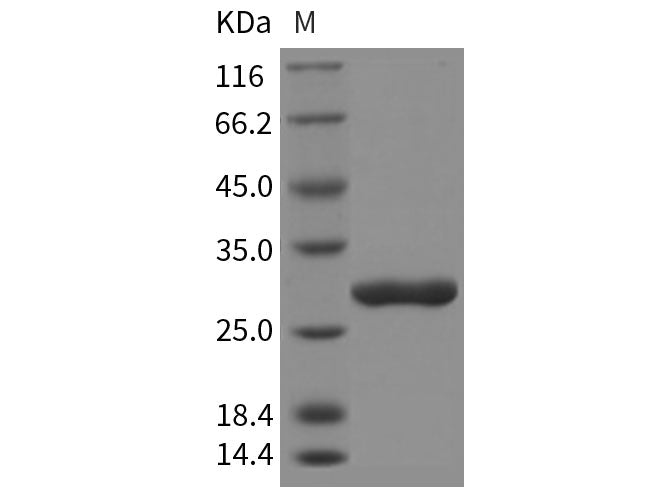 Recombinant Rat Chymotrypsinogen B/CTRB1 Protein (His Tag)