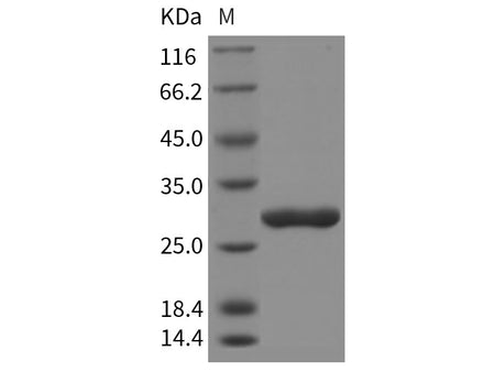 Recombinant Rat Chymotrypsinogen B/CTRB1 Protein (His Tag)