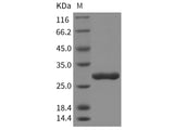 Recombinant Rat Chymotrypsinogen B/CTRB1 Protein (His Tag)