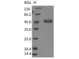 Recombinant Rat Cathepsin E/CTSE Protein (His Tag)