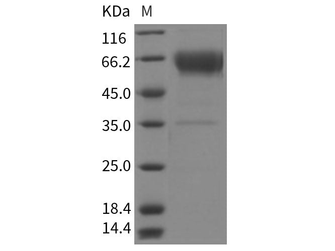 Recombinant Rat BTLA/CD272 Protein (ECD, Fc Tag)(Active)