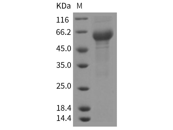 Recombinant Rat IL6RA/CD126 Protein (ECD, His Tag)(Active)