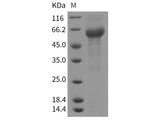 Recombinant Rat IL6RA/CD126 Protein (ECD, His Tag)(Active)