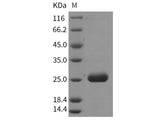 Recombinant Rat PRL2A1/Prolactin-2A1 Protein (His Tag)