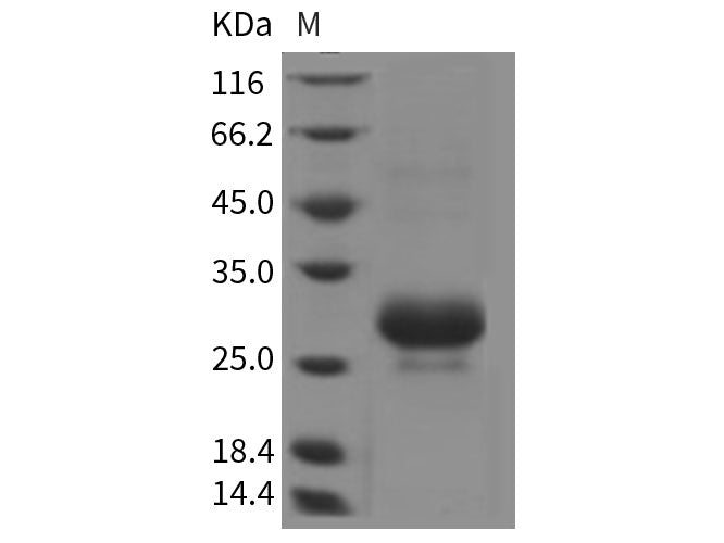 Recombinant Rat CTHRC1 Protein (His Tag)