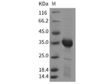Recombinant Rat HAAO/3-HAO Protein (His Tag)
