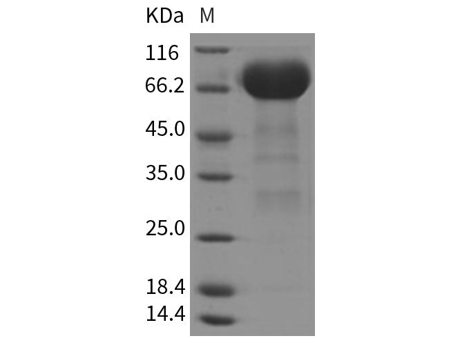 Recombinant Rat EphA3 Protein (His Tag)(Active)