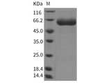 Recombinant Rat IL-22R/IL22RA1 Protein (ECD, Fc Tag)