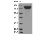 Recombinant Rat CSF1R/CD115 Protein (His Tag)(Active)