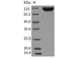 Recombinant Rat CSF1R/CD115 Protein (Fc Tag)(Active)