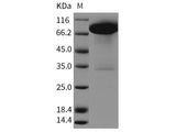 Recombinant Rat DDR1 Kinase/CD167 Protein (Fc Tag)