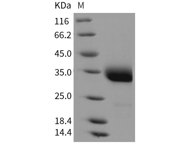 Recombinant Rat Layilin/LAYN Protein