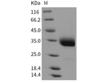 Recombinant Rat Layilin/LAYN Protein