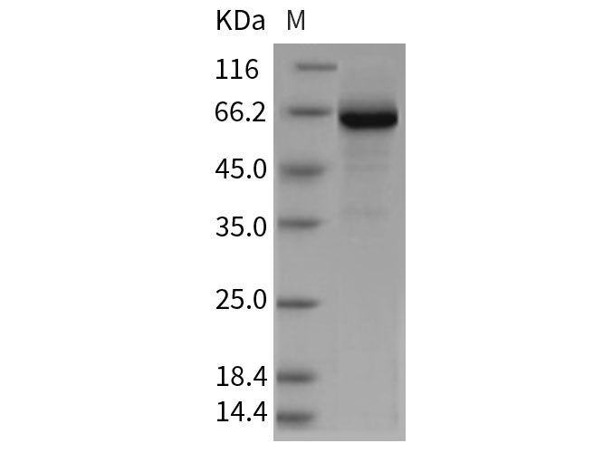 Recombinant Rat GP1BB/CD42c Protein (Fc Tag)