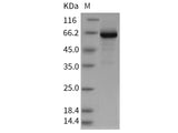 Recombinant Rat GP1BB/CD42c Protein (Fc Tag)