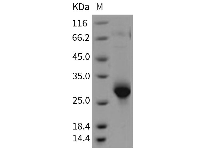 Recombinant Rat CLM-9/TREM4 Protein (His Tag)