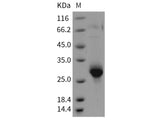 Recombinant Rat CLM-9/TREM4 Protein (His Tag)