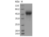 Recombinant Rat Tissue Factor/CD142 Protein (His Tag)
