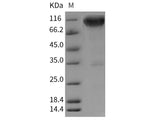 Recombinant Rat TrkA/NTRK1 Protein (Fc Tag)(Active)