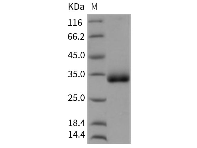 Recombinant Rat CHODL/Chondrolectin Protein (His Tag)
