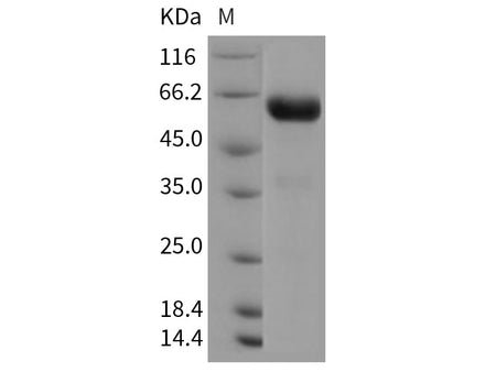 Recombinant Rat CHODL/Chondrolectin Protein (Fc Tag)