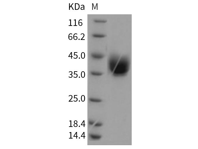 Recombinant Rat ART4 Protein (His Tag)