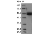 Recombinant Rat ICOS/AILIM/CD278 Protein (Fc Tag)