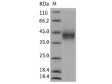 Recombinant Rat B7-H3/CD276 Protein (His Tag)