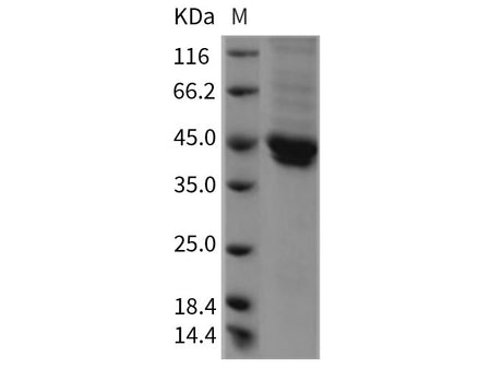Recombinant Rat JAM-B/CD322 Protein (His Tag)(Active)