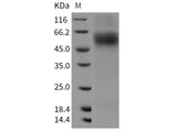 Recombinant Rat MSR1/SCARA1/CD204 Protein (His Tag)