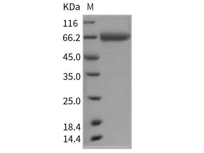 Recombinant Rat CD157/BST1 Protein (Fc Tag)