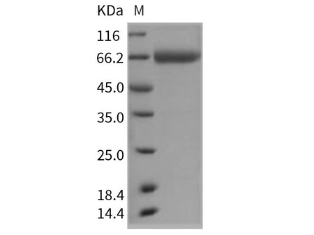Recombinant Rat CD157/BST1 Protein (Fc Tag)