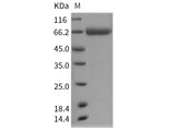 Recombinant Rat CD157/BST1 Protein (Fc Tag)