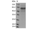 Recombinant Rat DDR2 Kinase/CD167b Protein (His Tag)
