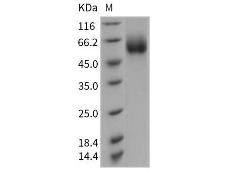 Recombinant Rat CD98 Protein (His Tag)