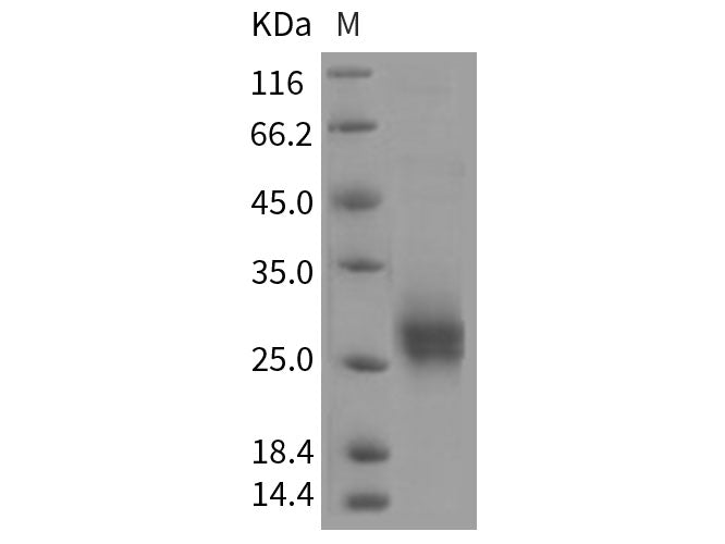 Recombinant Rat CD90/THY-1 Protein (His Tag)