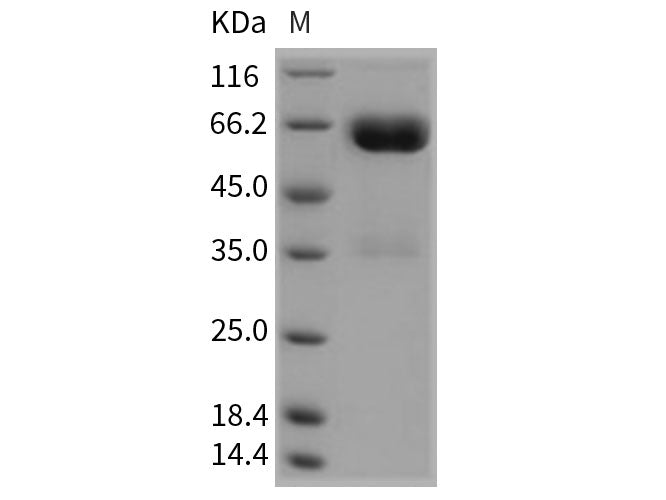 Recombinant Rat LILRA5 Protein (Fc Tag)