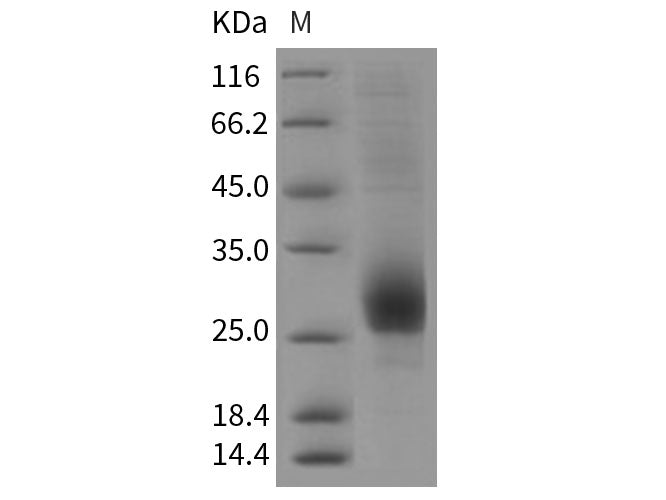 Recombinant Rat CD79B/B29 Protein (His Tag)