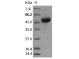 Recombinant Rat CD79B/B29 Protein (Fc Tag)
