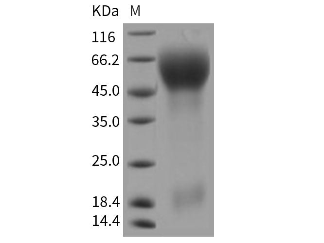 Recombinant Rat CD133/PROM1/Prominin 1 Protein (His Tag)