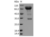 Recombinant Rat CD133/PROM1/Prominin 1 Protein (Fc Tag)