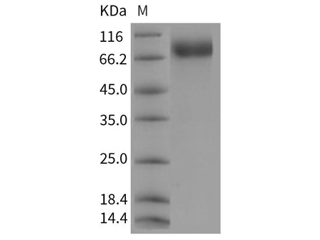 Recombinant Rat c-KIT/CD117 Protein (His Tag)