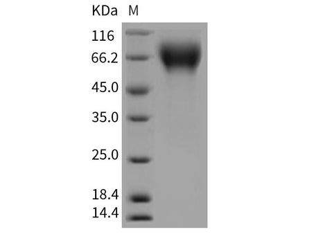 Recombinant Rat CD6/TP120 Protein (His Tag)(Active)