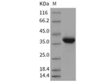 Recombinant Rat EpCAM/TROP-1 Protein (His Tag)