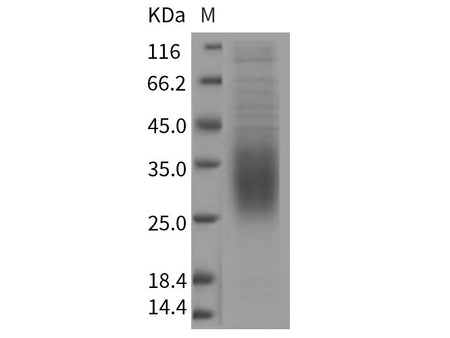 Recombinant Rat CD47 Protein (His Tag)(Active)