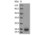 Recombinant Rat CD59 Protein (His Tag)