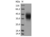 Recombinant Rat CD48 Protein (His Tag)