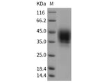 Recombinant Rat CD48 Protein (Fc Tag)