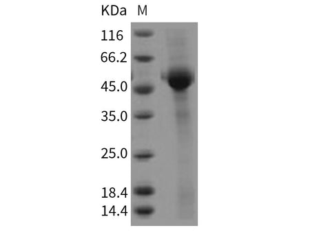 Recombinant Rat CD8A/MAL Protein (Fc Tag)