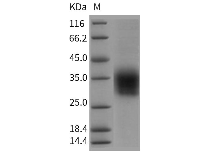 Recombinant Rat CLEC4A2/DCIR Protein (His Tag)